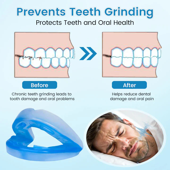 ✨Blizkox™ SnoreRelief – FDA-Approved Anti-Snoring Mouthpiece🔥