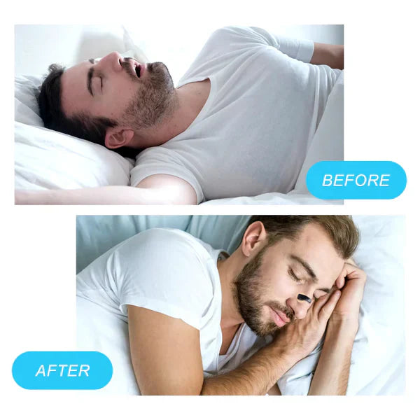 Magnetic Nose Patch – Breathing Expander Keeping You Breathing, Naturally.