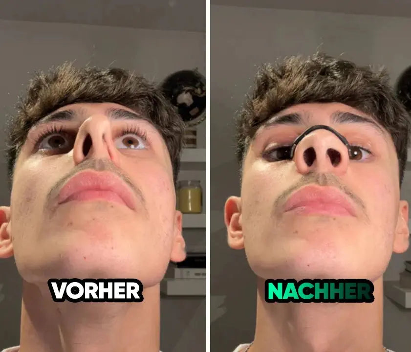 Magnetic Nose Patch – Breathing Expander Keeping You Breathing, Naturally.