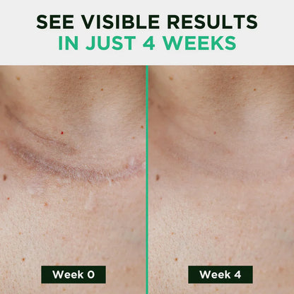 Blizkox™ ✅MEDICAL-GRADE SILICONE SCAR RECOVERY SHEETS