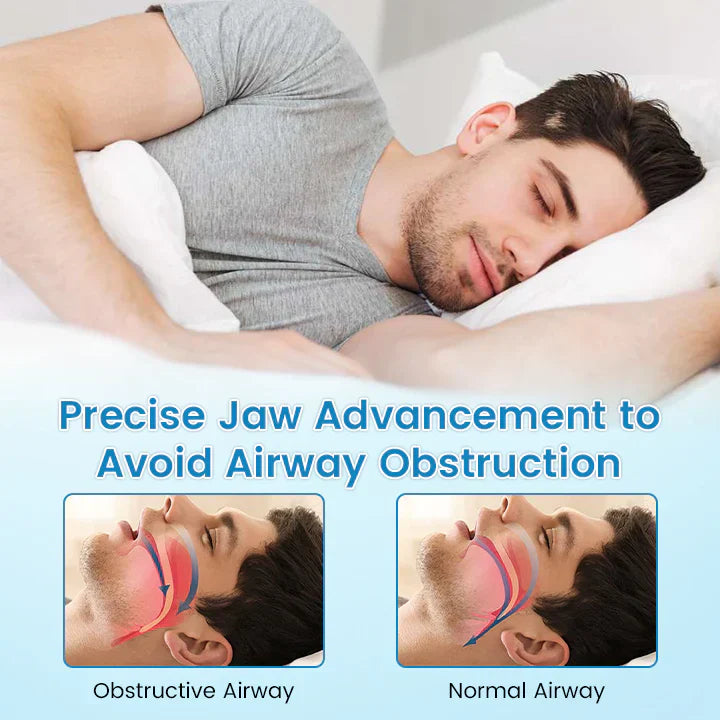 ✨Blizkox™ SnoreRelief – FDA-Approved Anti-Snoring Mouthpiece🔥
