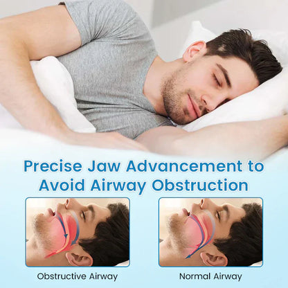 ✨Blizkox™ SnoreRelief – FDA-Approved Anti-Snoring Mouthpiece🔥