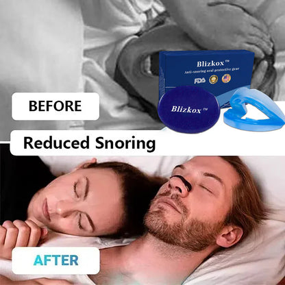 ✨Blizkox™ SnoreRelief – FDA-Approved Anti-Snoring Mouthpiece🔥