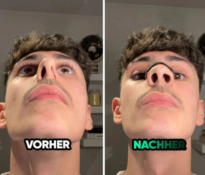 Magnetic Nose Patch – Breathing Expander Keeping You Breathing, Naturally.